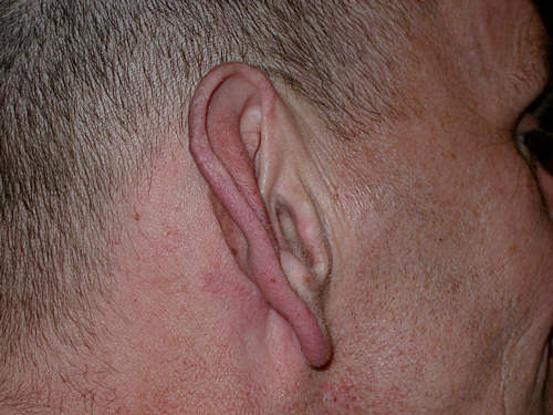 43Loui2004.jpg